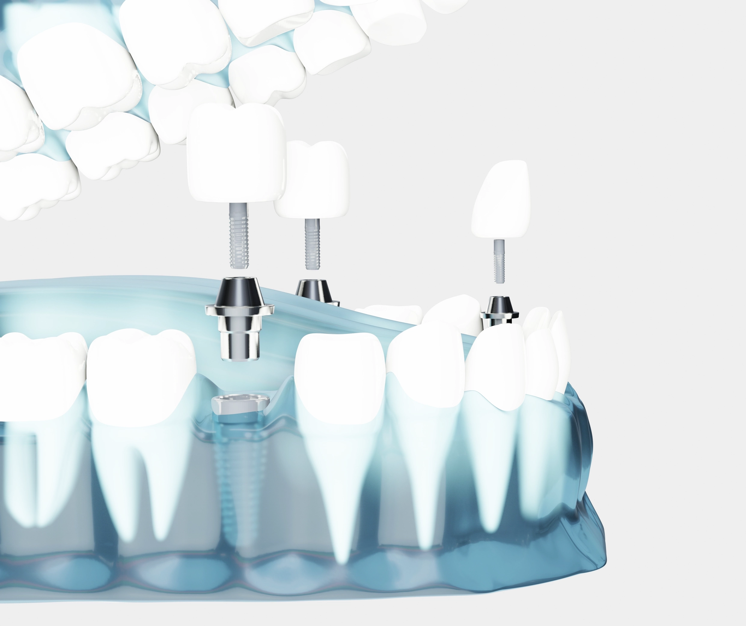 ポイント4の画像